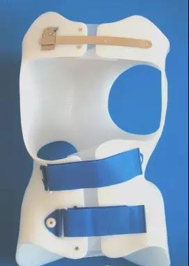 适应症:用于顶椎在t6以下,cobb角小于45°的特发性脊柱侧弯色努固定器